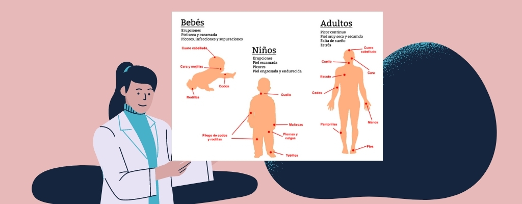 blog Cómo proteger la piel atópica en invierno
