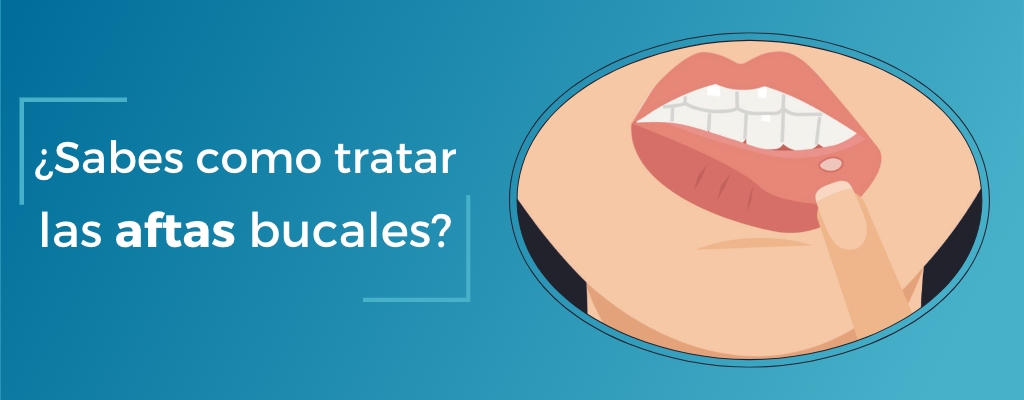 blog Todo lo que debes saber para curar las llagas en la boca