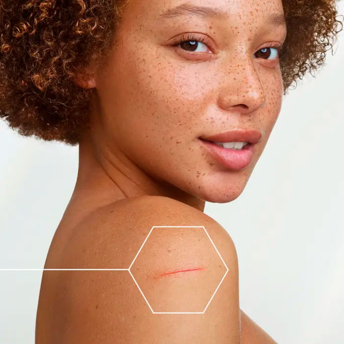 A-derma Epitheliale Ultra Repair Crema Reparadora Anti-marcas Ha+ 100ml