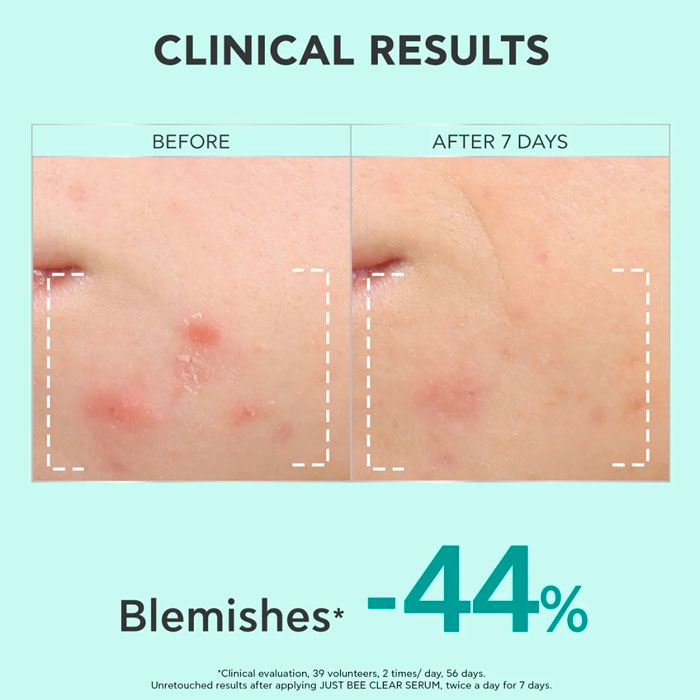 Apivita Just Bee Clear Sérum Anti-imperfecciones Anti-marcas Afina la Piel 30ml