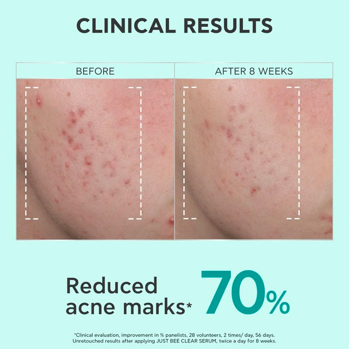 Apivita Just Bee Clear Sérum Anti-imperfecciones Anti-marcas Afina la Piel 30ml