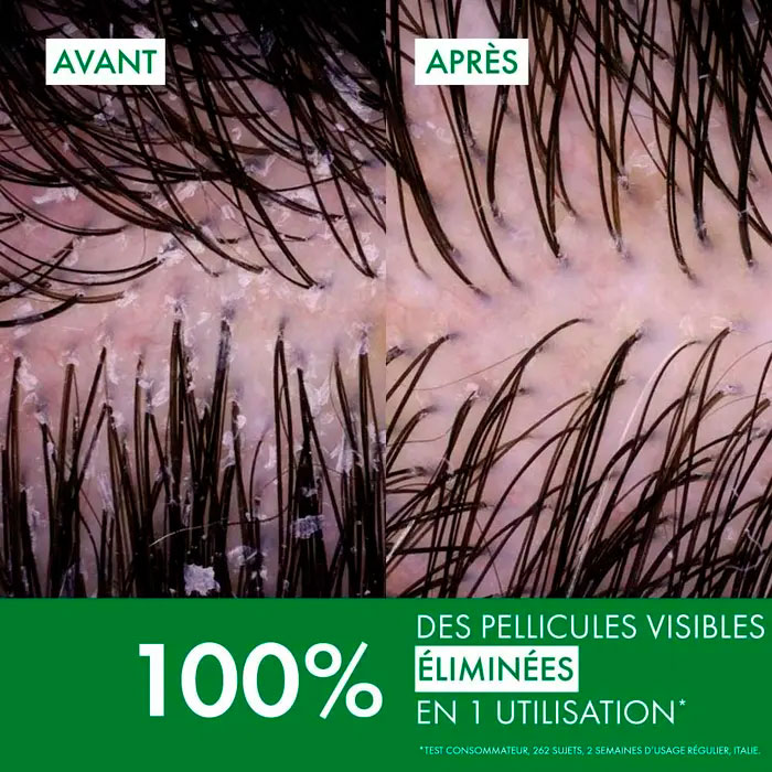 Dercos Champú Anticaspa Ds Cabello Normal Graso Ecorefill 390ml
