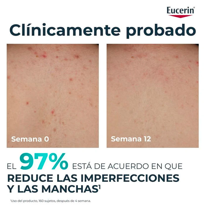 Eucerin Dermopure Clinical Crema Corporal Correctora 200ml