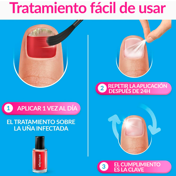 Excilor Forte Tratamiento de la Micosis de Las Uñas Color Rojo
