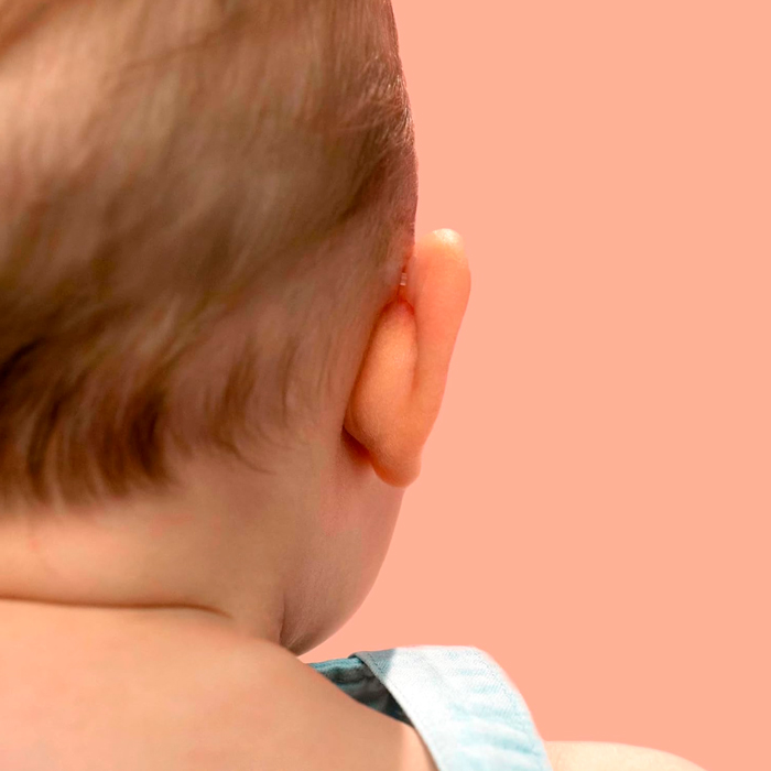 Otostick Bebé 8 Correctores