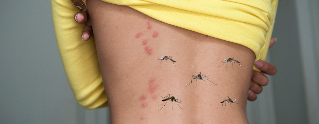 Picaduras de insectos: cómo prevenirlas y qué hacer si ya te han picado