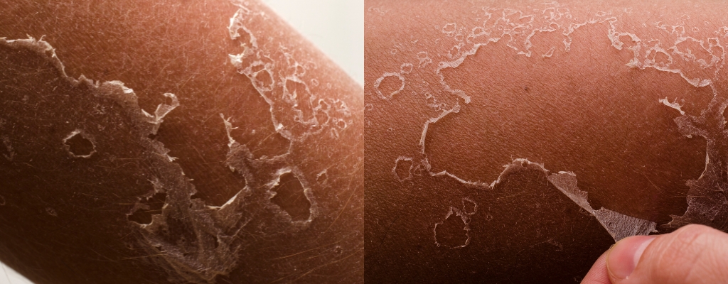 Piel tras el sol: rutina aftersun para reparar, calmar y mantener el bronceado bonito