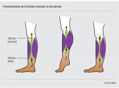piernas con insuficiencia vascular crónica